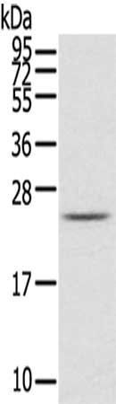 RAB2A antibody