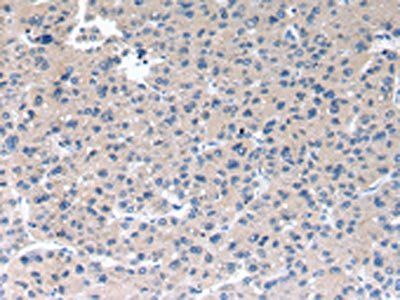 RAB2A Antibody