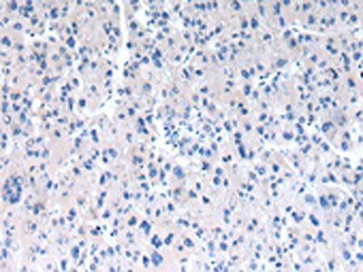 RAB2A Antibody