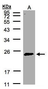 RAB2A antibody [C2C3], C-term