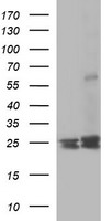 RAB30 Antibody