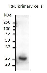Rab31 Antibody