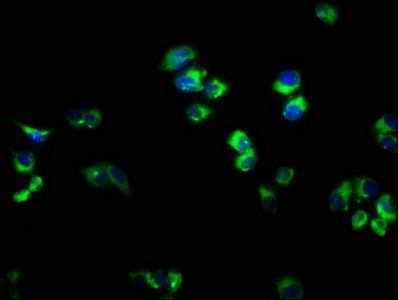 RAB33A Antibody