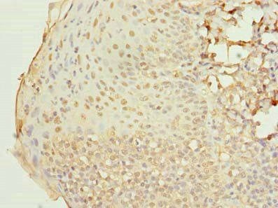 RAB33A Antibody