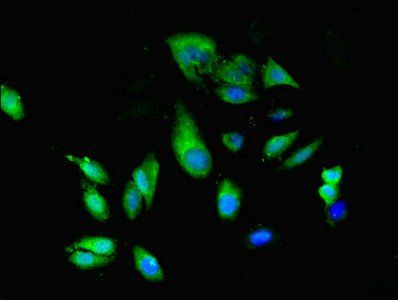 RAB35 antibody