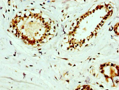 RAB35 Antibody