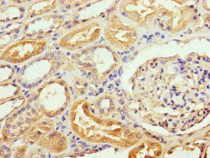 RAB35 Antibody