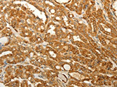 RAB35 Antibody