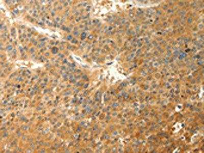 RAB35 Antibody