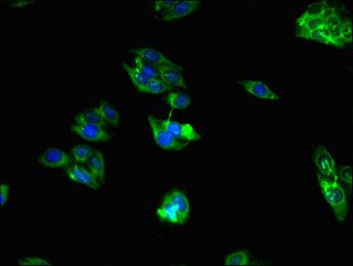 RAB39B Antibody