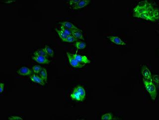 RAB39B antibody