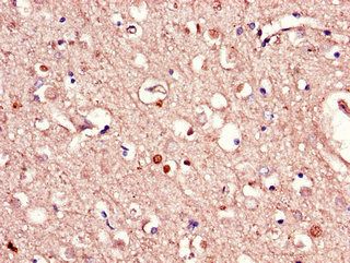 RAB39B Antibody