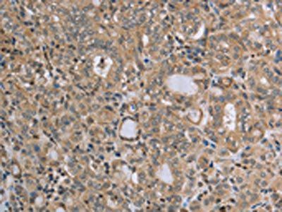 RAB39B Antibody