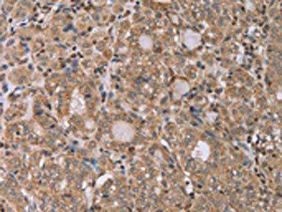 RAB39B Antibody