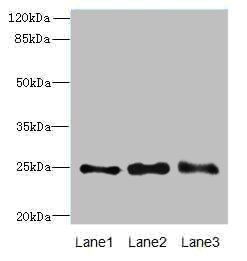 RAB3B Antibody