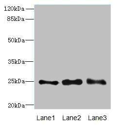 RAB3B antibody