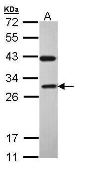 RAB3C antibody [N1C3]