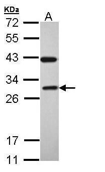 RAB3C antibody