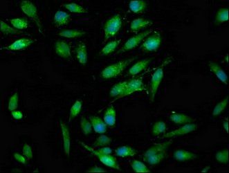 RAB3GAP1 Antibody