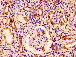 RAB3GAP1 Antibody