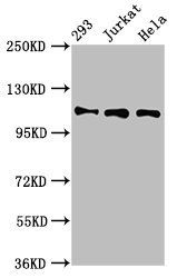 RAB3GAP1 Antibody