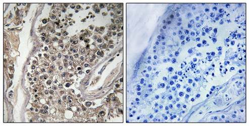 RAB3GAP1 Antibody
