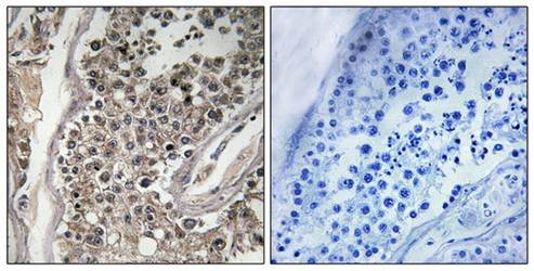 RAB3GAP1 antibody