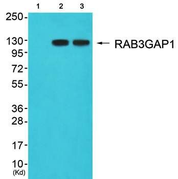 RAB3GAP1 Antibody