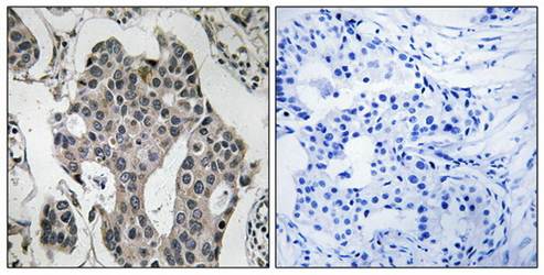 RAB3GAP2 antibody