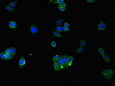 RAB3IP Antibody