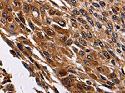 RAB41 Antibody