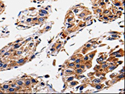 RAB41 Antibody