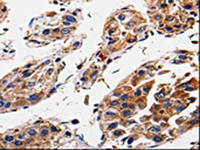 RAB41 antibody