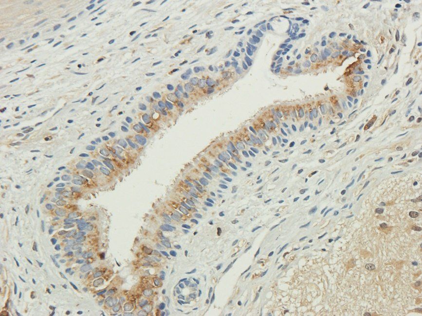 RAB5A antibody