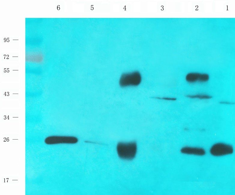 RAB5A antibody