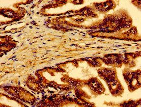 RAB5A Antibody