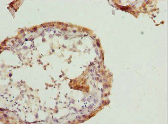 RAB5B Antibody