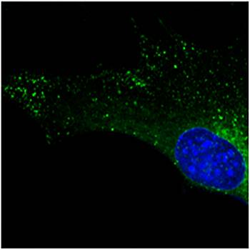 Rab5b antibody