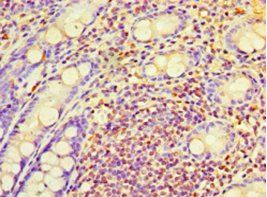 RAB6A Antibody
