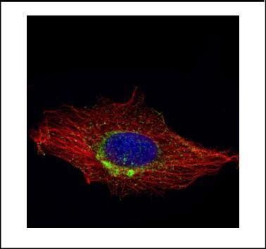 RAB6A, member RAS oncogene family Antibody