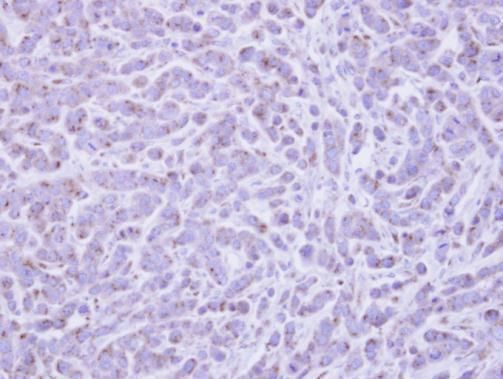 RAB6A antibody