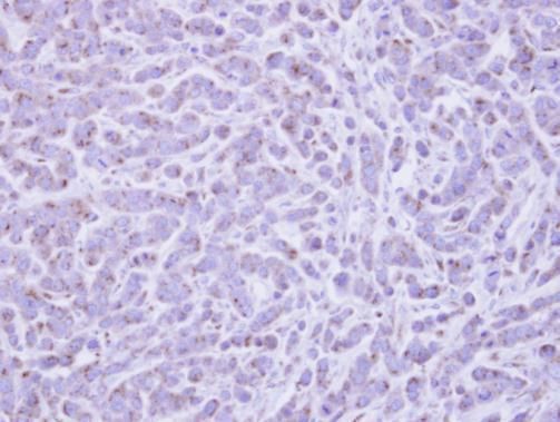 RAB6A, member RAS oncogene family Antibody