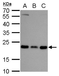 RAB6A, member RAS oncogene family Antibody