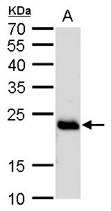 RAB6A, member RAS oncogene family Antibody