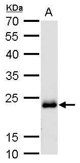 RAB6A, member RAS oncogene family Antibody