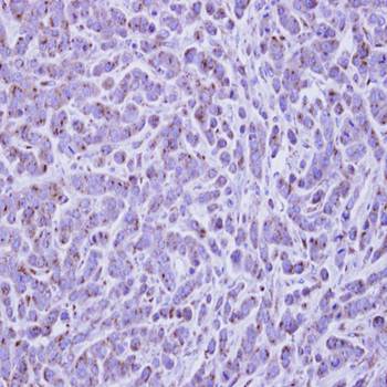RAB6A antibody
