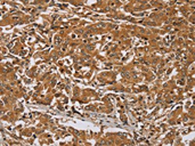 RAB8A Antibody