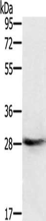 RAB8B antibody