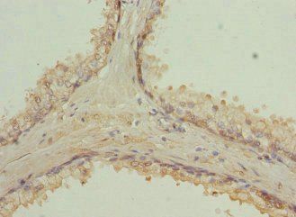 RAB9A Antibody