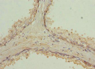 RAB9A antibody